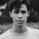 Diamond Dermabrasion